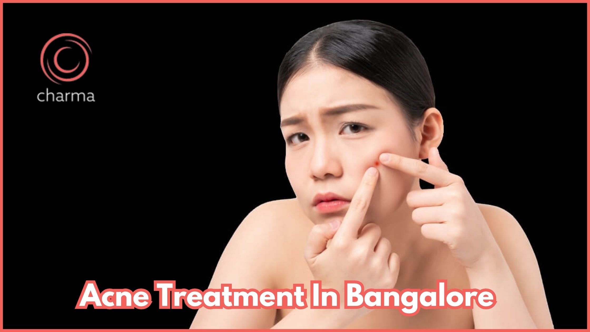 Best Acne Treatment In Bangalore - Charma Clinic